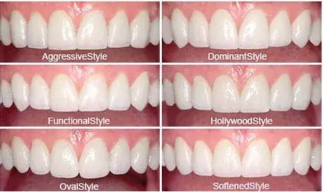 veneers, carillas, cheapest, miami, kendall, downtown, southbeach, fiu, closest to me, Dentist near me, dentista cerca de mi, best dentist miami, mejor dentista miami, pizza near me, chinese near me, food near me, crown dentist miami, cheapest dentist miami, root canal dentist miami, cheapest root canal miami